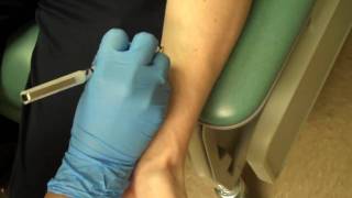 Allergy Testing Step 1 Skin Prick Testing [upl. by Suiraj]