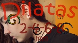 DILATAS 08MM  PROCESO Y EXPERIENCIA by galiavlogs [upl. by Vanda932]