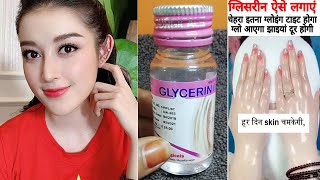 सर्दियों में Glycerin इस तरह से लगाए की रातोरात चेहरा व हाथपैर दूध जैसे गोरे सॉफ्ट Bright हो जाए [upl. by Darla]