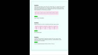 ACLS Pretest Questions Latest 2024 2025 All Correct [upl. by Yhtomit631]