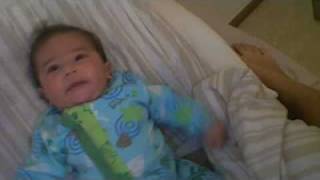 baby having seizures Infantile Spasms or Ohtahara Syndrome [upl. by Dulce]