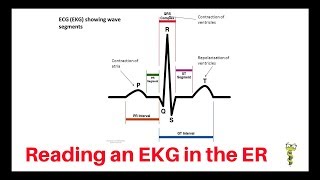 How to quickly read an EKG in the emergency department [upl. by Crompton]