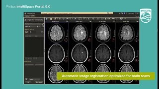 Philips IntelliSpace Portal 90 Clinical application MR LoBI [upl. by Oirramaj]