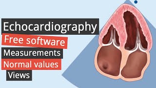 Echocardiography Free software [upl. by Lahsiv991]