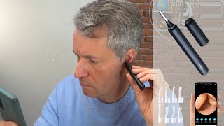 Comment contrôler soimême et nettoyer ses oreilles  Bouchons croutes cerumen PEARLTVFR [upl. by Nhepets540]