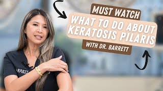 What To Do About Keratosis Pilaris  Barrett MedSpa [upl. by Eimmit]