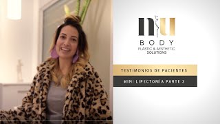 Testimonio de Minilipectomía y Liposucción NuBody  Parte 3 [upl. by Martz121]