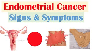 Endometrial Cancer Signs amp Symptoms amp Why They Occur [upl. by Zeus]