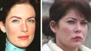 Lara Flynn Before and After Plastic Surgery Photos [upl. by Anirak]