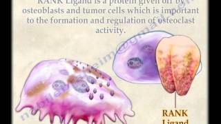 Osteoclasts  Everything You Need To Know  Dr Nabil Ebraheim [upl. by Analed]