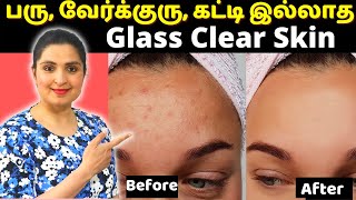 இதை மட்டும் செய்தா போதும் பரு வேர்க்குரு அண்டவே அண்டாது  Prickly Heat Pimples Heat Boils Remedy [upl. by Emilio]