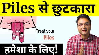 10 Tips To Get Rid Of Piles  Piles Treatment At Home  पाइल्स का इलाज  by Dr Saleem Zaidi [upl. by Oirram]