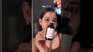 Minimalist 10 Vitamin C Serum Review 7 Days Challenge minimalist vitamincserum ashortsaday [upl. by Hayman]