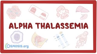 Alphathalassemia  an Osmosis Preview [upl. by Iat]