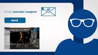 Philips IntelliSpace Portal 7 iXR integration interventional Xray [upl. by Mastrianni254]