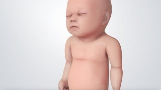 Infant Distress Warning Signs Grunting Baby Sound [upl. by Naejarual120]