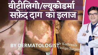 भयानक चर्म रोग को खत्म करने के लिए रामबाण उपाय  Remedies for Skin Diseases  Acharya Balkrishna Ji [upl. by Jovitta]