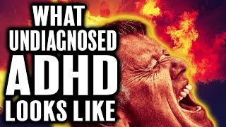 What Adult ADHD Can Look Like 🔍 [upl. by Yniatirb489]