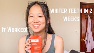 ZIMBA Teeth Whitening Strips Review BEFORE amp AFTER [upl. by Oiramed]