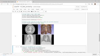 Medical image processing in your web browser using Jupyter notebooks and 3D Slicer [upl. by Grania466]