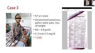 Hypercalcemia Case Based Approach Dr Sumit Chakraborty [upl. by Solly962]