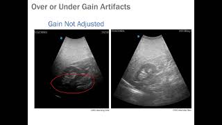 eFAST for EMS Appendix E US Machine and Mechanics Part 2 [upl. by Margaretta803]