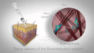 In vitro study of RRS HA injectable mesotherapy  Video abstract 95108 [upl. by Mosley]