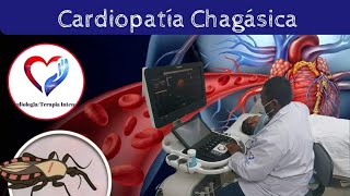 CardiopatÍa chagásica [upl. by Enitsirhc531]