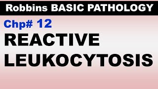 Ch12  Reactive Leukocytosis  EBV Infection  Infectious Mononucleosis  Blood Pathology [upl. by Vada]