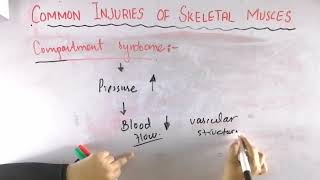 Compartment syndrome  Common injuries of skeletal muscle  Biomechanics of skeletal muscle [upl. by Dnomsad]