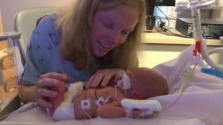 LullabyPlaying Pacifier Helps Premature Babies Thrive  UCLA Health Newsroom [upl. by Elinore]