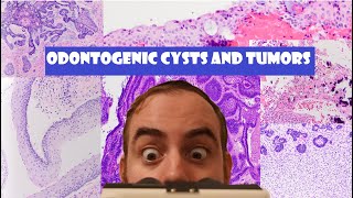 The ULTIMATE Odontogenic Cyst and Tumor Review Video [upl. by Siravat]