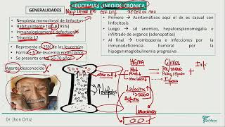 Hematología  Leucemias linfoide cronica leucemia mieloide cronico smpc [upl. by Nodarse878]