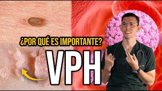 Virus del Papiloma Humano ¿Por qué es IMPORTANTE DrPoloGuerrero [upl. by Nagn]