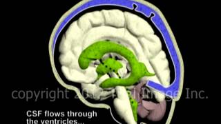 Hydrocephalus and Cerebrospinal Fluid CSF circulation by Dr Cal Shipley MD [upl. by Gavan399]