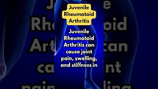 Juvenile Rheumatoid Arthritis [upl. by Durnan136]