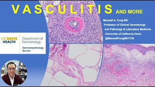 DERMATOPATHOLOGY Vasculitis Vasculopathy amp More [upl. by Barde467]