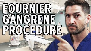 Fournier Gangrene Procedure  Brace Yourselves For This Story [upl. by Drolyag]