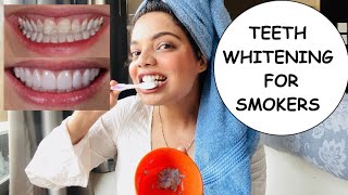 Teeth whitening for smokers at home  Super Effective  Beauty’s crown [upl. by Nelda]