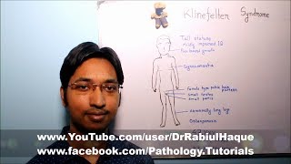 Klinefelter Syndrome  Part 1 HD [upl. by Michaele]