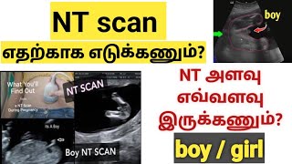 NT scan during pregnancy in tamil  3rd month scan during pregnancy in tamil  nuchal scan  NT scan [upl. by Esinehs]