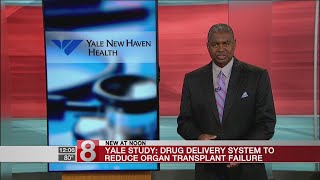 Yale develops drug delivery system to reduce organ transplant complications [upl. by Lotsirhc]