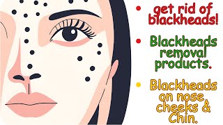 The ultimate guide to removing blackheads [upl. by Ennej]