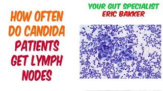 Do Candida Patients Often Have Swollen Lymph Nodes [upl. by Grimbal]