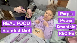 Blended Diet for Gtube Feeding  Purple Power Smoothie [upl. by Joane]