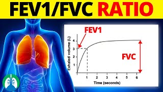 FEV1FVC Ratio Medical Definition  Quick Explainer Video [upl. by Teague]