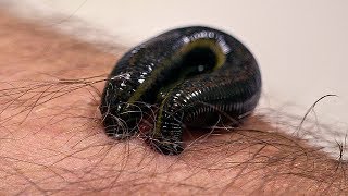 How Leeches are used in Modern Surgery  Earth Science [upl. by Eural706]