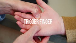 Trigger Finger Symptoms Causes and Treatment [upl. by Saretta702]