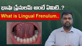 What is Lingual Frenulum  Oxy Dental [upl. by Anirhtak]