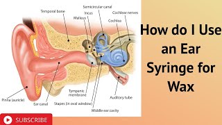 How do I Use an Ear Syringe for Wax [upl. by Nnaecyoj]